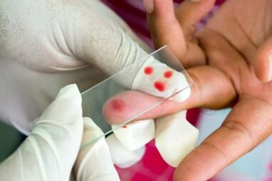 Mina diagnostikatu behatzaren artikulazioetan