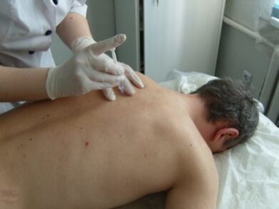 Osteokondrosi torazikorako kondroprotektoreen artikulazio barneko injekzioak